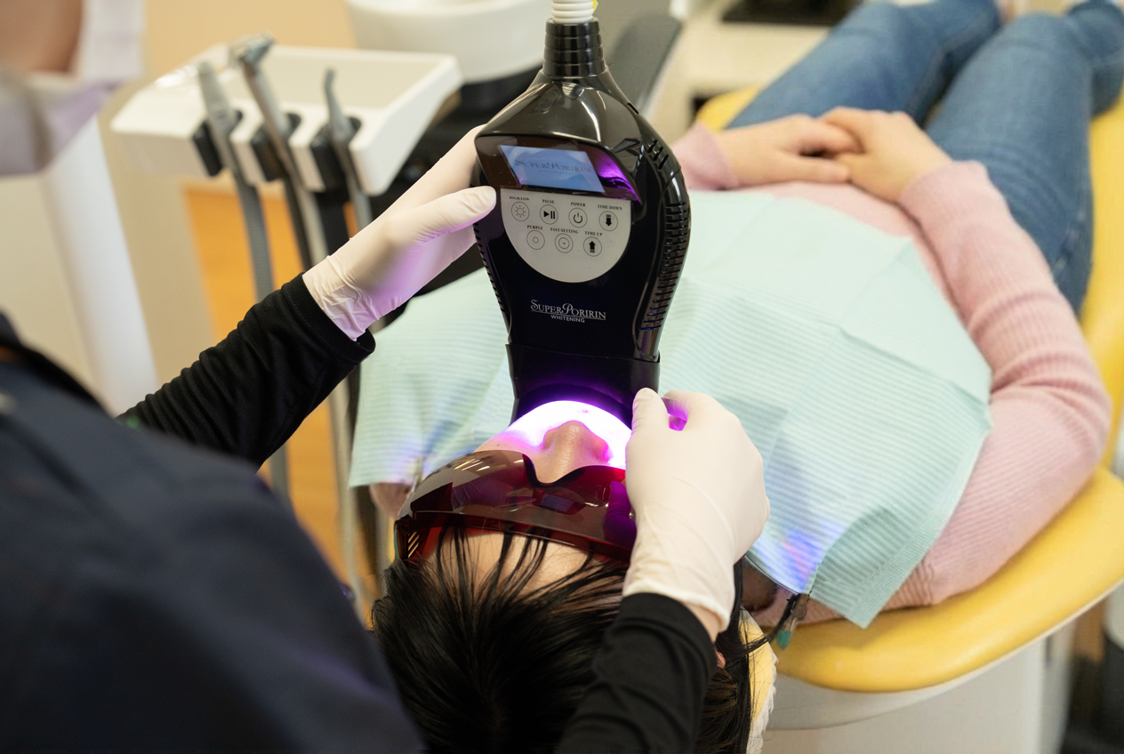 ホワイトニングのイメージ